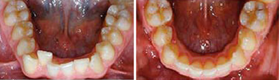 Athens Orthodontics - Dr. Κωνσταντίνος Τζαμάλας - Ορθοδοντικός Αθήνα
