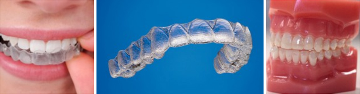 Athens Orthodontics - Dr. Κωνσταντίνος Τζαμάλας - Ορθοδοντικός Αθήνα