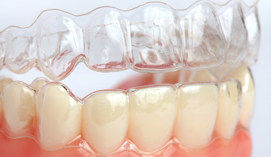 Athens Orthodontics - Dr. Κωνσταντίνος Τζαμάλας - Ορθοδοντικός Αθήνα