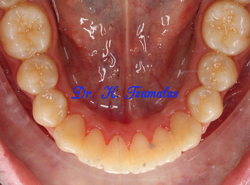 Athens Orthodontics - Dr. Κωνσταντίνος Τζαμάλας - Ορθοδοντικός Αθήνα