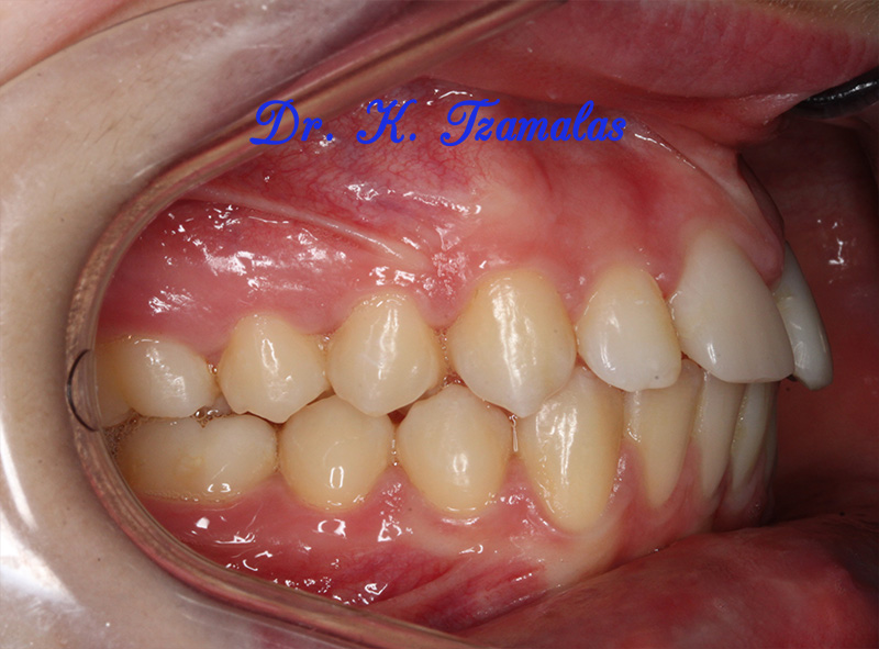Athens Orthodontics - Dr. Κωνσταντίνος Τζαμάλας - Ορθοδοντικός Αθήνα