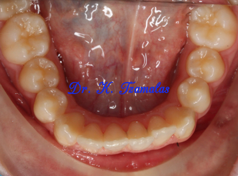 Athens Orthodontics - Dr. Κωνσταντίνος Τζαμάλας - Ορθοδοντικός Αθήνα