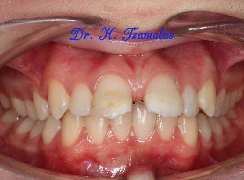 Athens Orthodontics - Dr. Κωνσταντίνος Τζαμάλας - Ορθοδοντικός Αθήνα
