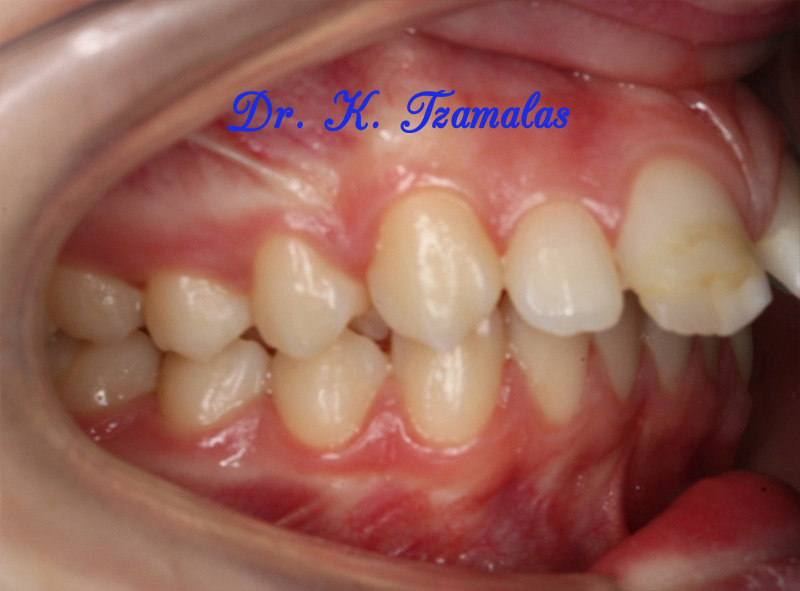 Athens Orthodontics - Dr. Κωνσταντίνος Τζαμάλας - Ορθοδοντικός Αθήνα