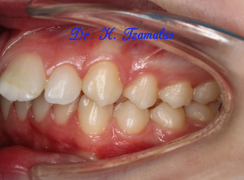 Athens Orthodontics - Dr. Κωνσταντίνος Τζαμάλας - Ορθοδοντικός Αθήνα