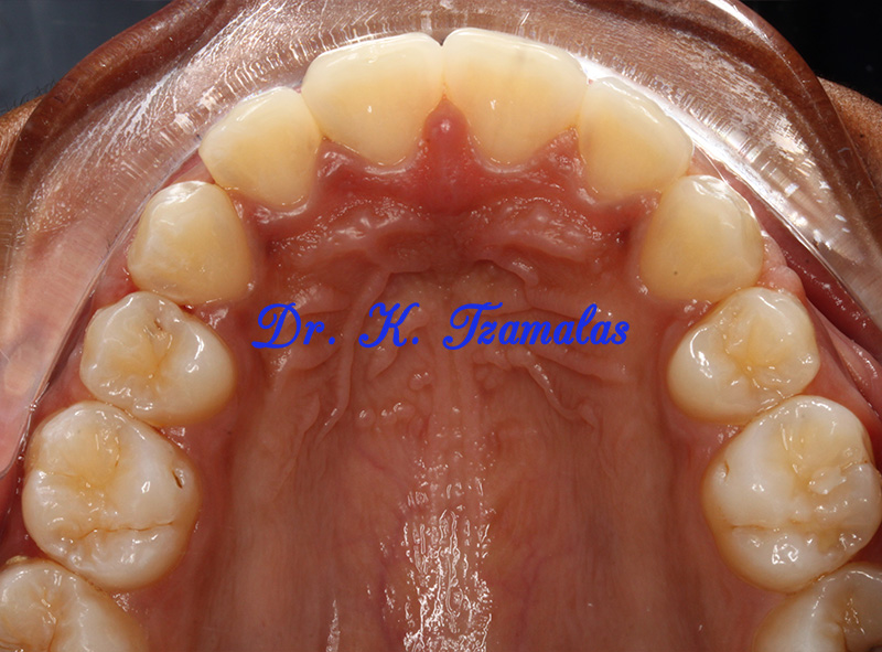 Athens Orthodontics - Dr. Κωνσταντίνος Τζαμάλας - Ορθοδοντικός Αθήνα