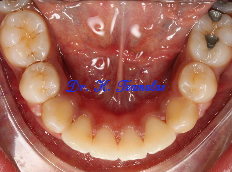 Athens Orthodontics - Dr. Κωνσταντίνος Τζαμάλας - Ορθοδοντικός Αθήνα