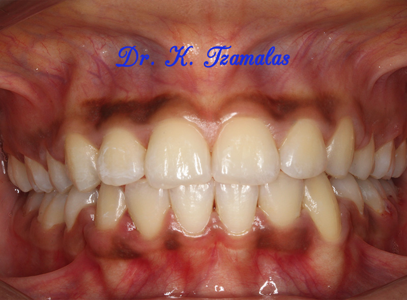 Athens Orthodontics - Dr. Κωνσταντίνος Τζαμάλας - Ορθοδοντικός Αθήνα