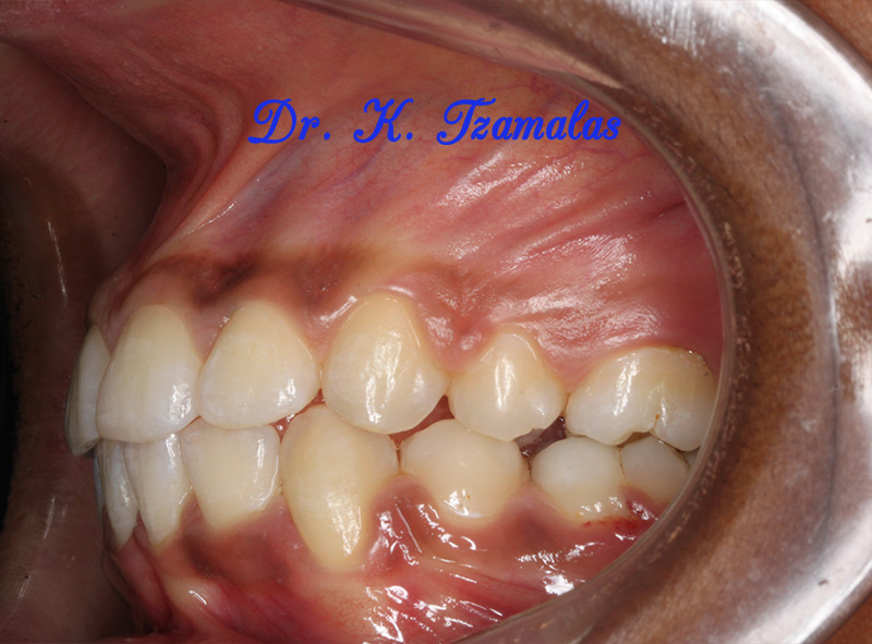 Athens Orthodontics - Dr. Κωνσταντίνος Τζαμάλας - Ορθοδοντικός Αθήνα