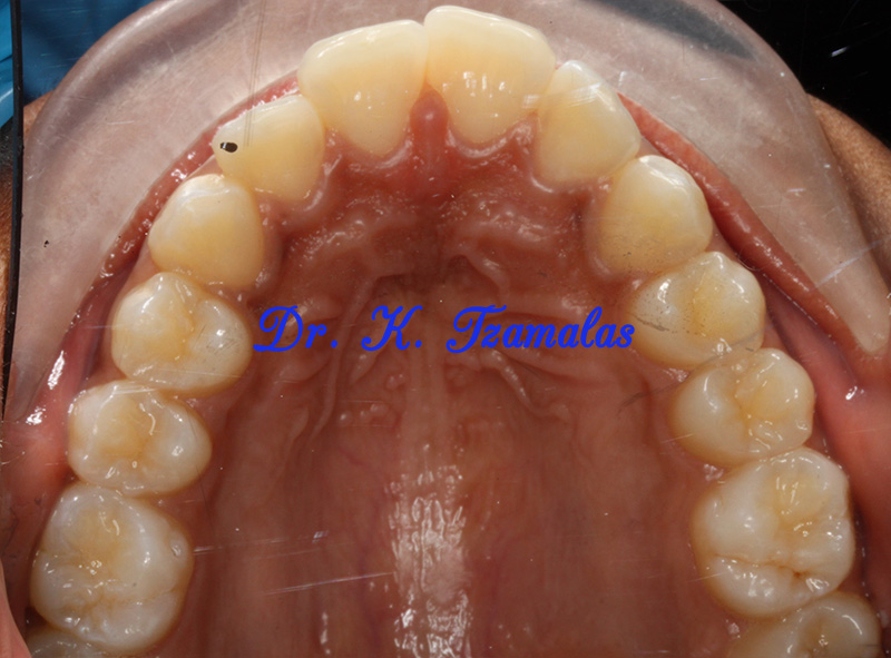 Athens Orthodontics - Dr. Κωνσταντίνος Τζαμάλας - Ορθοδοντικός Αθήνα