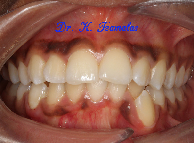 Athens Orthodontics - Dr. Κωνσταντίνος Τζαμάλας - Ορθοδοντικός Αθήνα