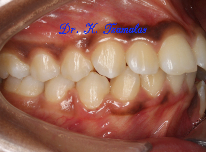 Athens Orthodontics - Dr. Κωνσταντίνος Τζαμάλας - Ορθοδοντικός Αθήνα