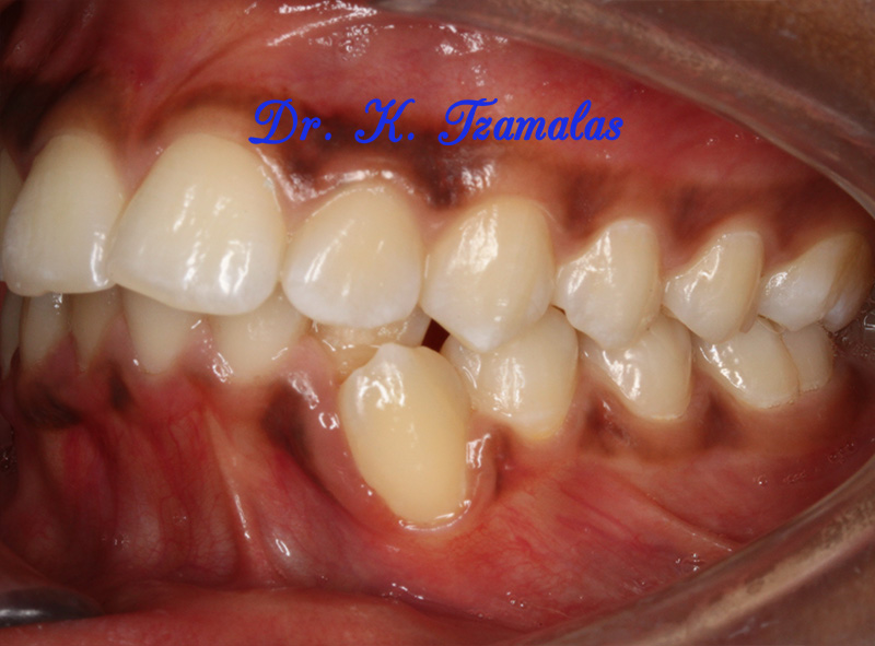 Athens Orthodontics - Dr. Κωνσταντίνος Τζαμάλας - Ορθοδοντικός Αθήνα