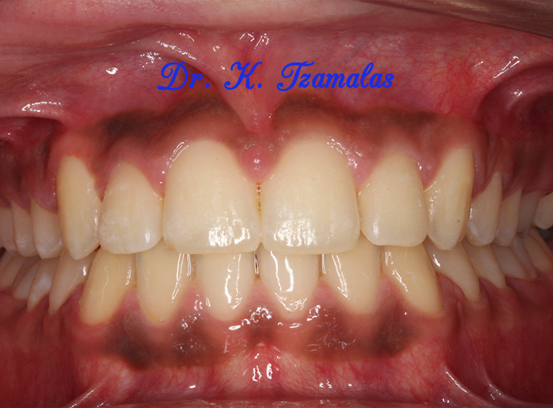 Athens Orthodontics - Dr. Κωνσταντίνος Τζαμάλας - Ορθοδοντικός Αθήνα