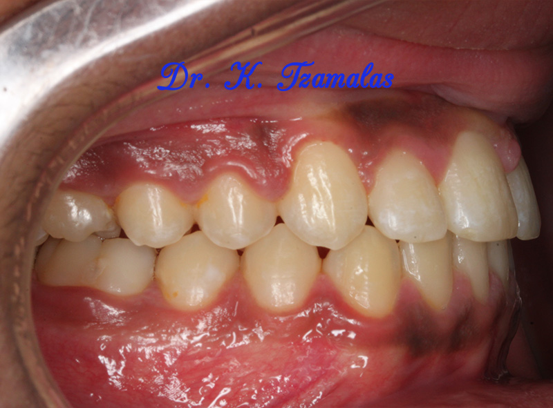 Athens Orthodontics - Dr. Κωνσταντίνος Τζαμάλας - Ορθοδοντικός Αθήνα
