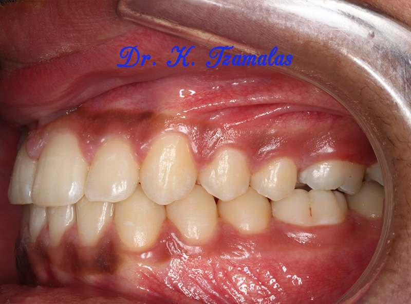 Athens Orthodontics - Dr. Κωνσταντίνος Τζαμάλας - Ορθοδοντικός Αθήνα