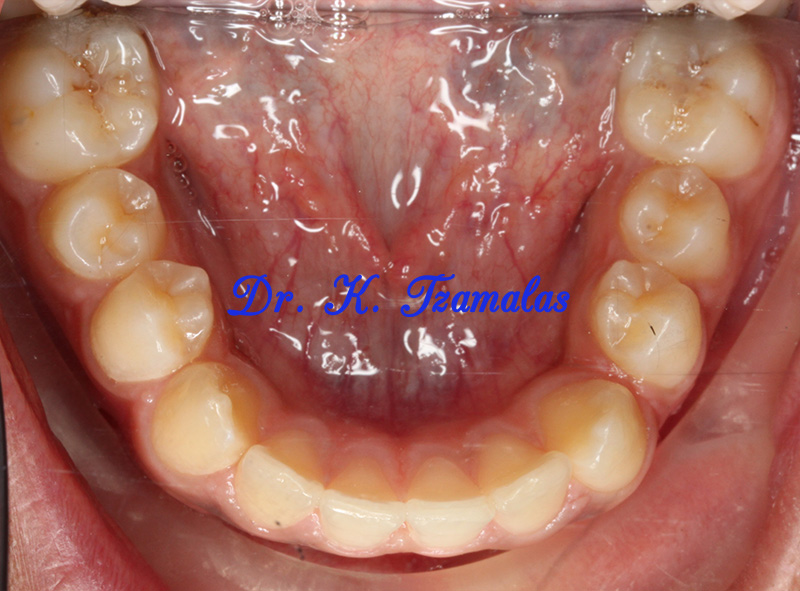 Athens Orthodontics - Dr. Κωνσταντίνος Τζαμάλας - Ορθοδοντικός Αθήνα