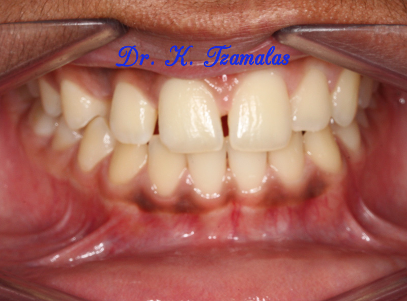 Athens Orthodontics - Dr. Κωνσταντίνος Τζαμάλας - Ορθοδοντικός Αθήνα