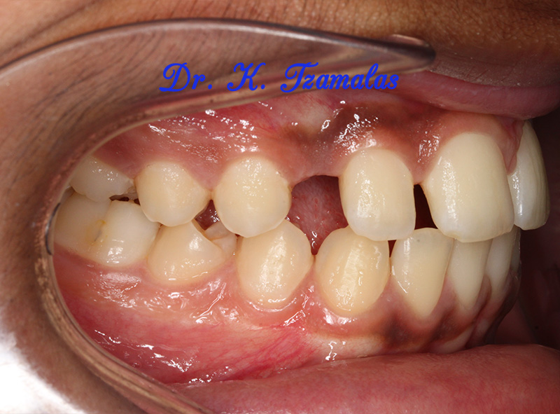 Athens Orthodontics - Dr. Κωνσταντίνος Τζαμάλας - Ορθοδοντικός Αθήνα