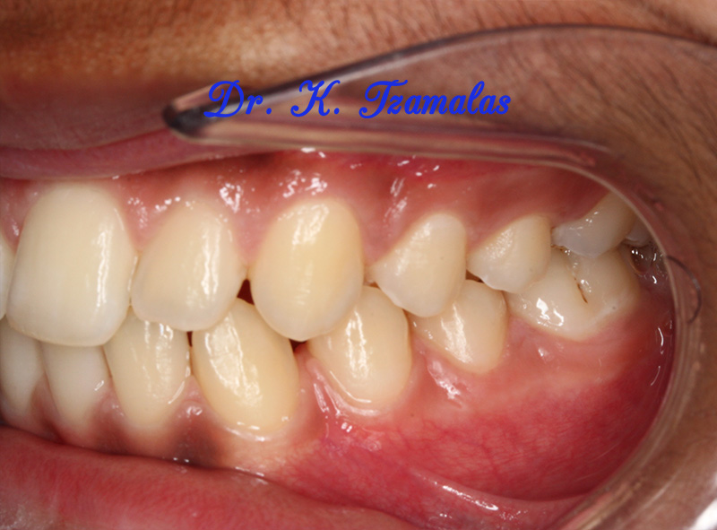 Athens Orthodontics - Dr. Κωνσταντίνος Τζαμάλας - Ορθοδοντικός Αθήνα
