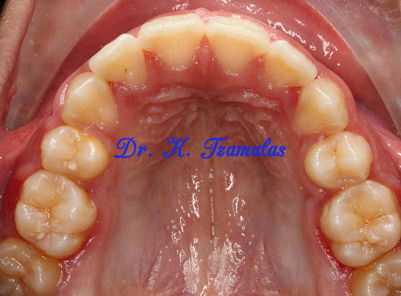 Athens Orthodontics - Dr. Κωνσταντίνος Τζαμάλας - Ορθοδοντικός Αθήνα