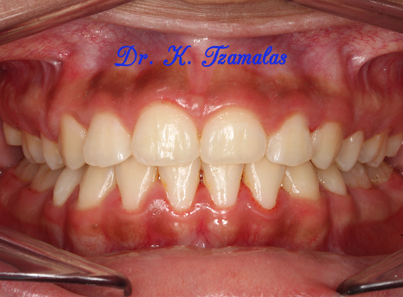 Athens Orthodontics - Dr. Κωνσταντίνος Τζαμάλας - Ορθοδοντικός Αθήνα