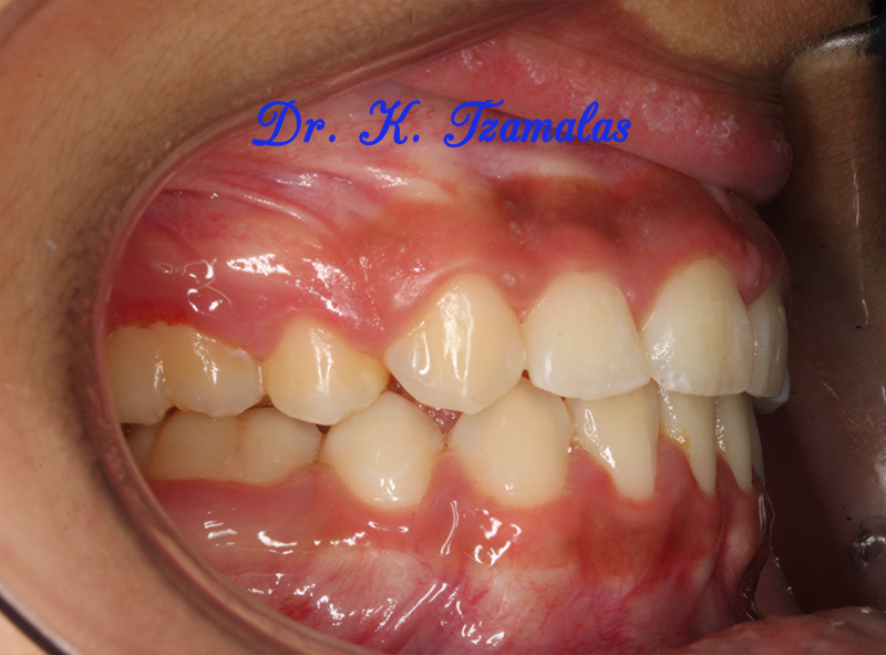 Athens Orthodontics - Dr. Κωνσταντίνος Τζαμάλας - Ορθοδοντικός Αθήνα
