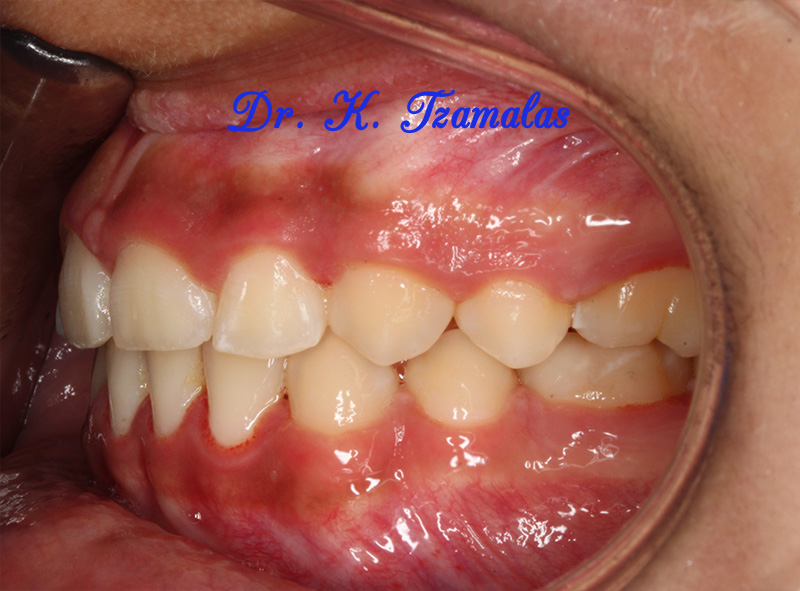 Athens Orthodontics - Dr. Κωνσταντίνος Τζαμάλας - Ορθοδοντικός Αθήνα