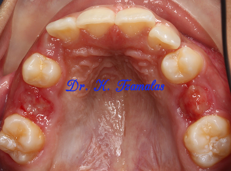 Athens Orthodontics - Dr. Κωνσταντίνος Τζαμάλας - Ορθοδοντικός Αθήνα