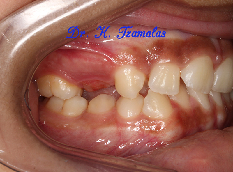 Athens Orthodontics - Dr. Κωνσταντίνος Τζαμάλας - Ορθοδοντικός Αθήνα