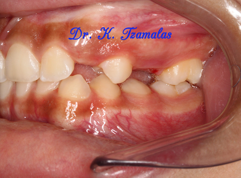 Athens Orthodontics - Dr. Κωνσταντίνος Τζαμάλας - Ορθοδοντικός Αθήνα