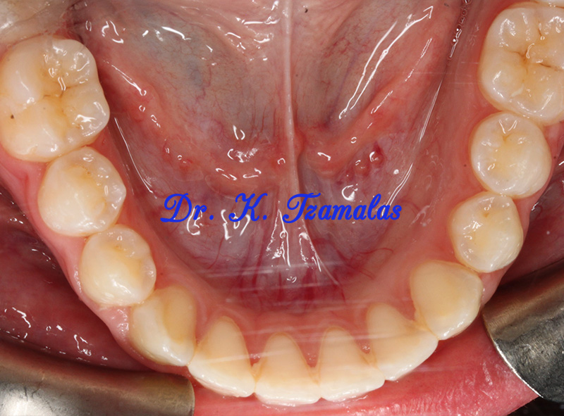 Athens Orthodontics - Dr. Κωνσταντίνος Τζαμάλας - Ορθοδοντικός Αθήνα