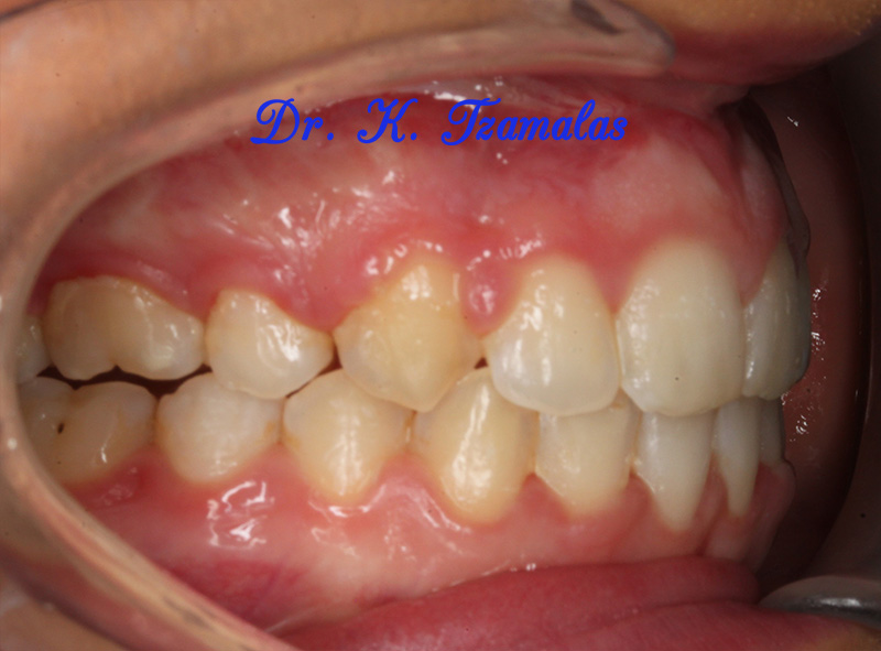 Athens Orthodontics - Dr. Κωνσταντίνος Τζαμάλας - Ορθοδοντικός Αθήνα