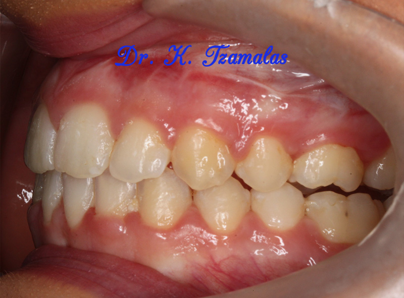 Athens Orthodontics - Dr. Κωνσταντίνος Τζαμάλας - Ορθοδοντικός Αθήνα