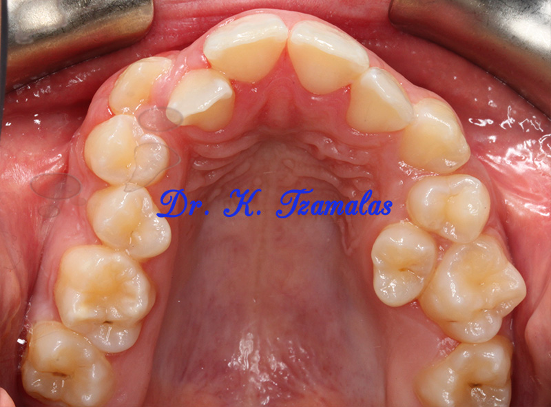 Athens Orthodontics - Dr. Κωνσταντίνος Τζαμάλας - Ορθοδοντικός Αθήνα