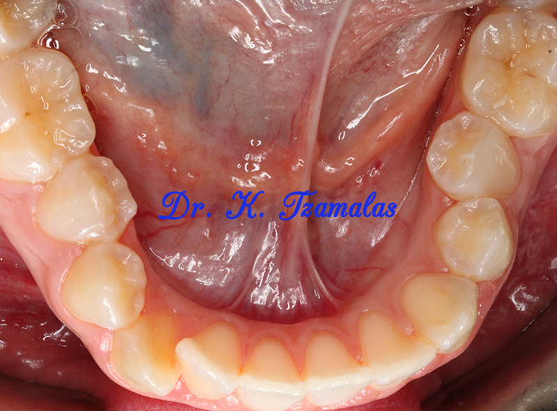 Athens Orthodontics - Dr. Κωνσταντίνος Τζαμάλας - Ορθοδοντικός Αθήνα