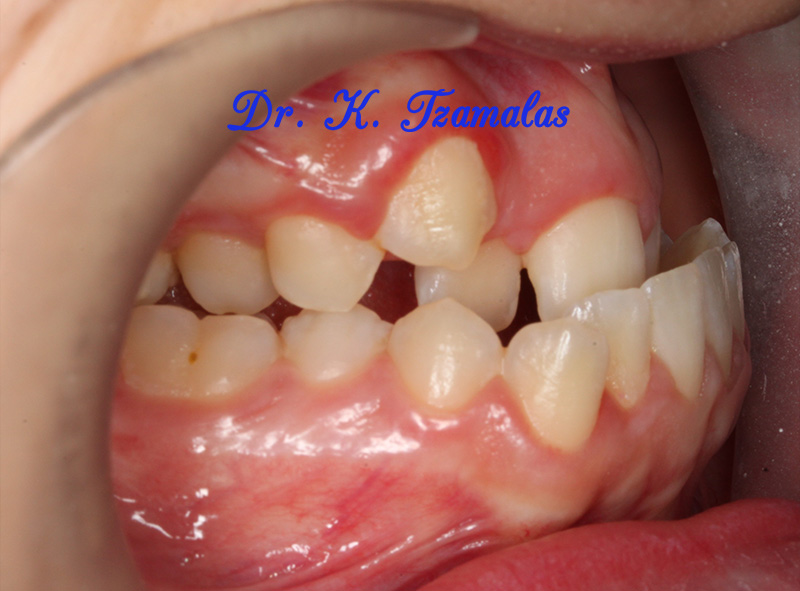 Athens Orthodontics - Dr. Κωνσταντίνος Τζαμάλας - Ορθοδοντικός Αθήνα