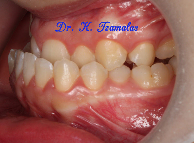 Athens Orthodontics - Dr. Κωνσταντίνος Τζαμάλας - Ορθοδοντικός Αθήνα