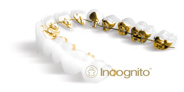 Athens Orthodontics - Dr. Κωνσταντίνος Τζαμάλας - Ορθοδοντικός Αθήνα
