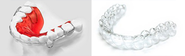 Athens Orthodontics - Dr. Κωνσταντίνος Τζαμάλας - Ορθοδοντικός Αθήνα