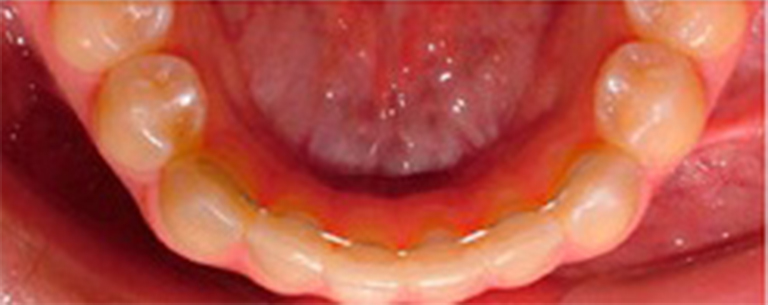 Athens Orthodontics - Dr. Κωνσταντίνος Τζαμάλας - Ορθοδοντικός Αθήνα
