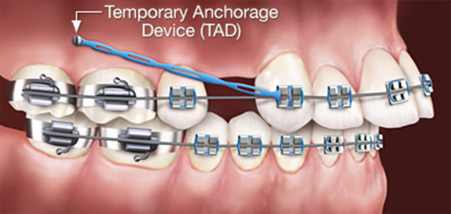 Athens Orthodontics - Dr. Κωνσταντίνος Τζαμάλας - Ορθοδοντικός Αθήνα